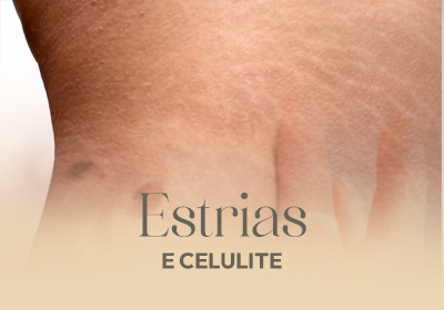 ESTRIAS.png