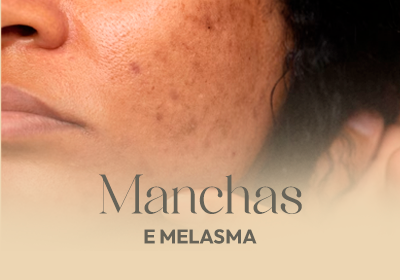 manchas.png